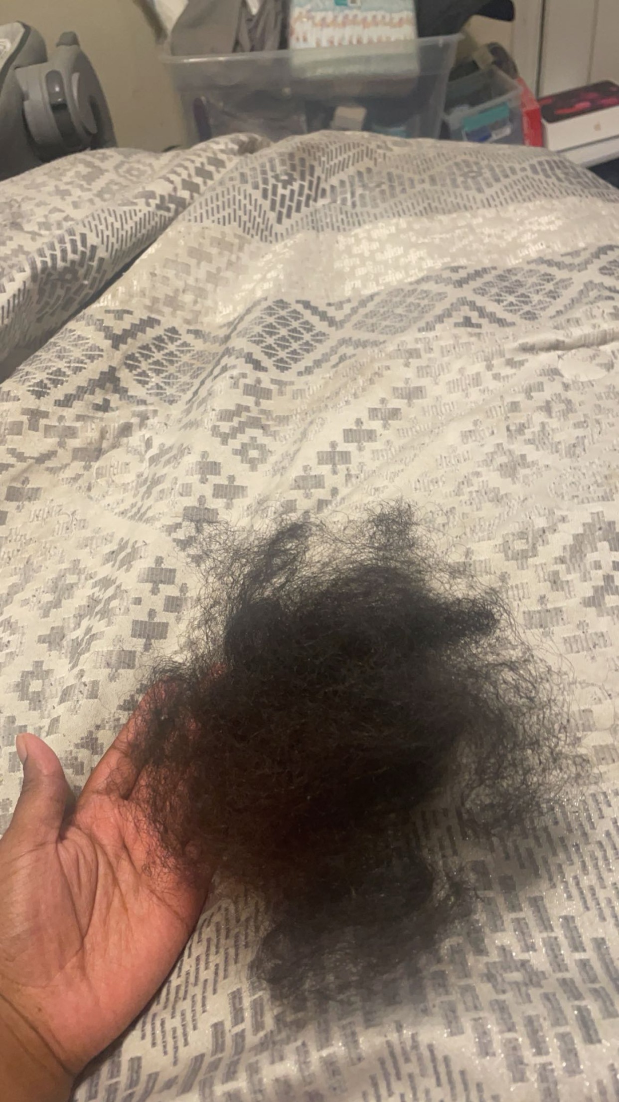 Postpartum Hair Shedding